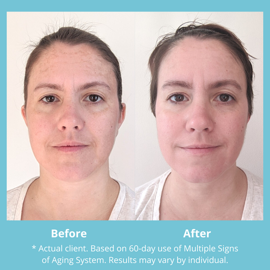 Results with the Multiple Signs of Aging System