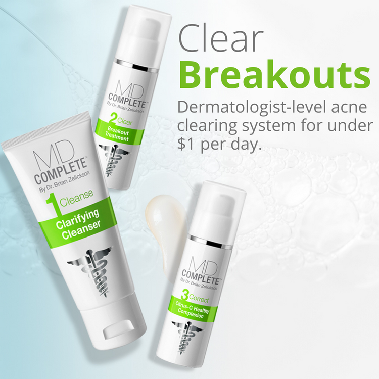Clear breakouts for less than $1 a day