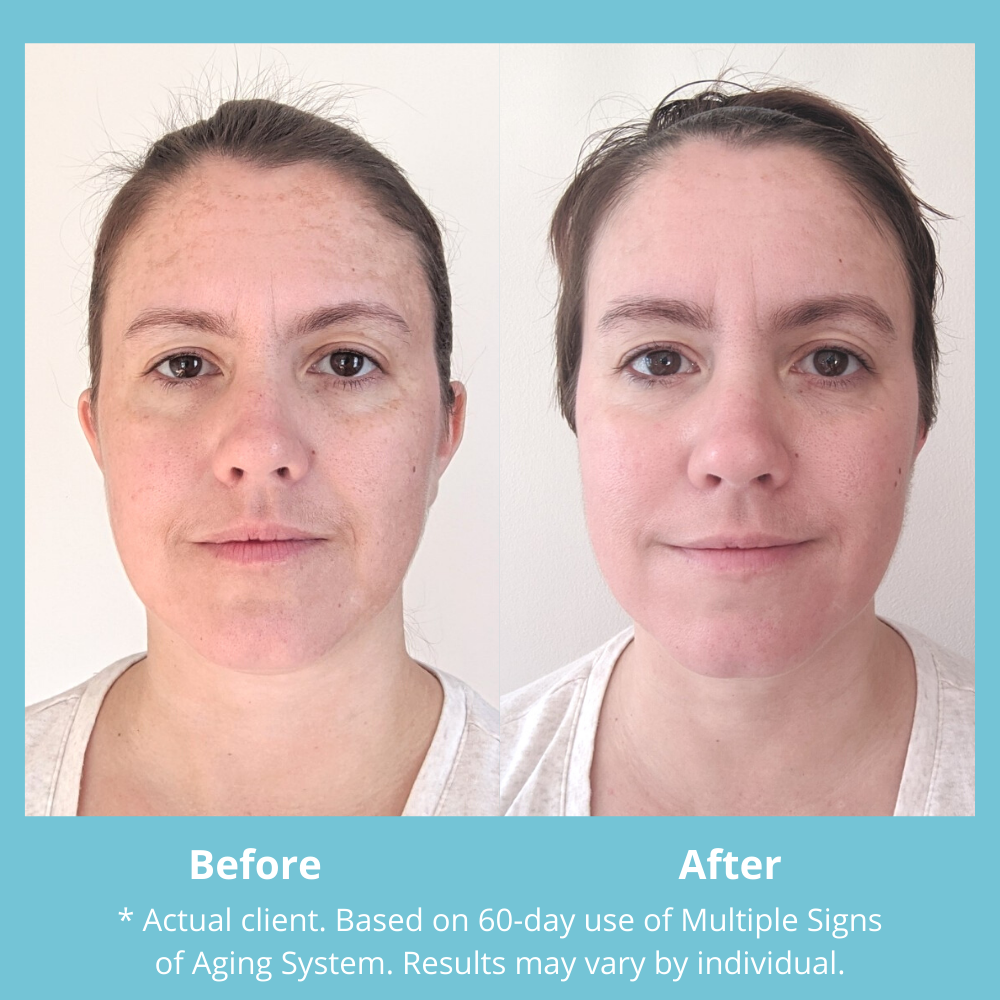 Results with Multiple Signs of Aging System