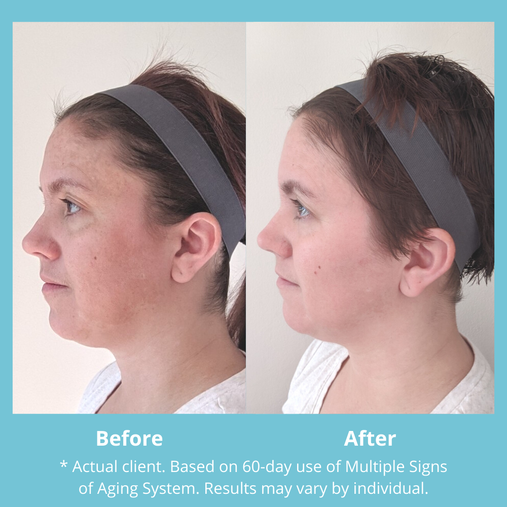 Multiple Signs of Aging System – MD Complete Skincare